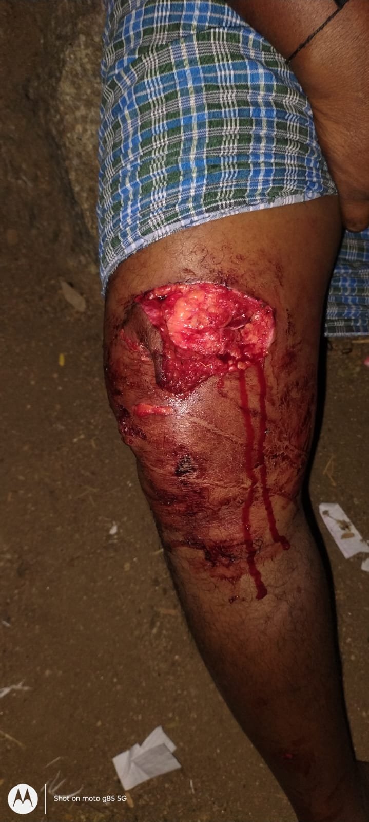 మేకల కాపరిపై ఎలుగుబంటి దాడి 
